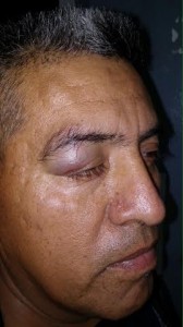 Un ojo amoratado a otro policia/ Foto Plumas Libres