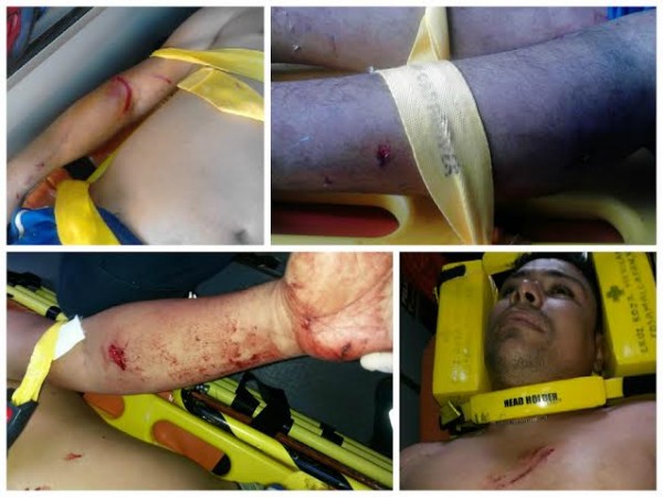 Mordidas en brazos, pecho, cuello le dejaron perros a este joven que vive de milagro/ Fotos Pablo Solano