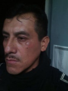 Policia agredido en la cara/ Foto Plumas Libres