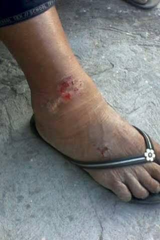 Las arrastraron con sus mercancías y lesionaron sus pies/ Foto Plumas Libres