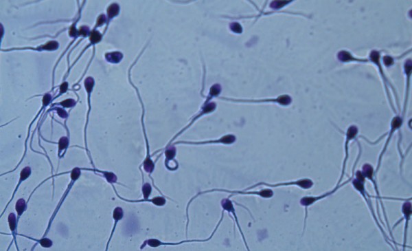 Espermatozoides-tenidos