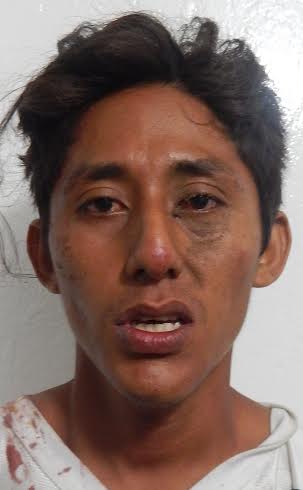Jonatán Martínez Rodríguez, de 24 años fue arrestado por ciudadanos que le dieron una "calentadita" antes de entregarlo a la policia que no hace su trabajo