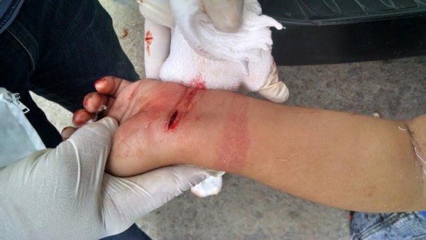 Estuvo a punto de perder la vida, pero llegaron a tiempo los de emergencias/ Foto.Solano