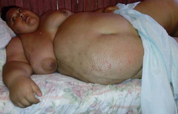 Gracias al gobernador Javier Duarte de Ochoa personal de salud en el estado acudió a la casa de Noé Fernández para que recibiera apoyo inmediato/ Foto cortesía Agencia Imagen del Golfo