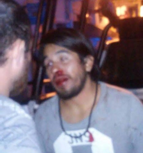Rudeza innecesaria contra otro fotógrafo/ Fco. de Luna