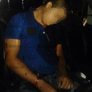 Este hombre fue abatido ayer en Martinez, aún no está identificado