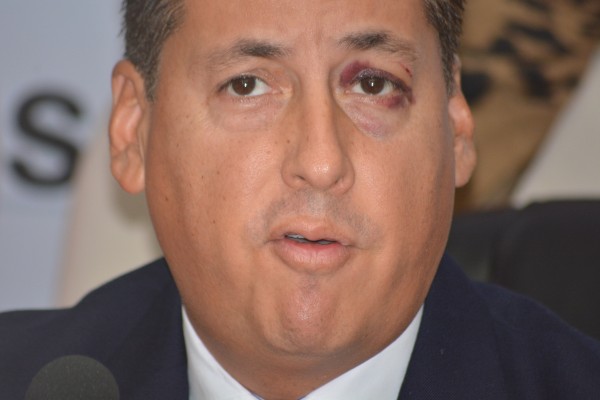 Alberto Silva Ramos apareció en la conferencia de prensa con un golpe en el ojo aunque no aclaró el motvo de este/Fotover