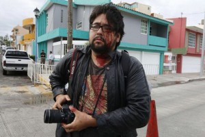 A Ivan Sánchez de MVS le rompieron la cabeza con un macanazo, a Raziél Roldán de Plumas Libres le rompieron su lente y agredieron a golpes por la espalda. ¡Bermudez ordenó los golpes!.