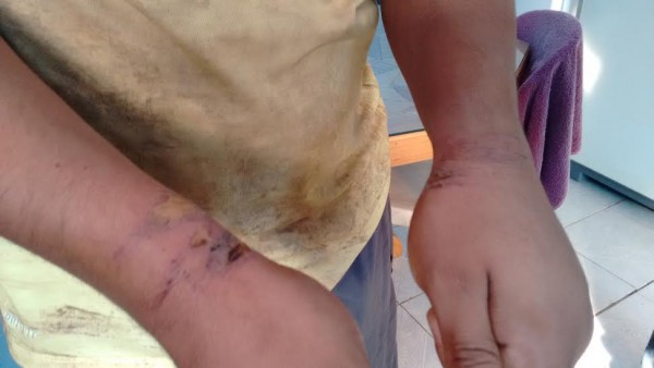 Los torturaron y golpearon por espacio de casi 5 días/ Foto Agencias