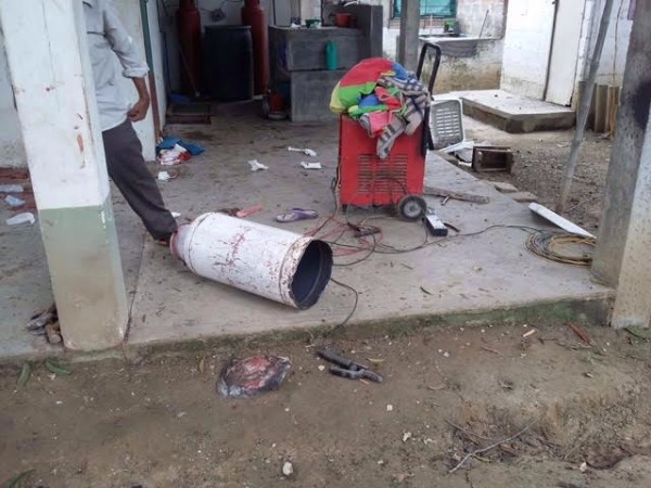 La mujer perdió ambos brazos tras explosión/ Dany Jácome