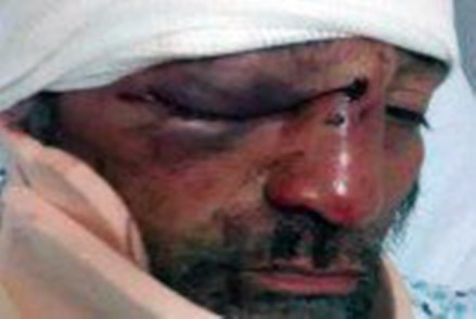 Periodista-golpeado-en-Michoacan-Foto-Especial-1