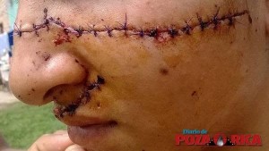 Ya la había engañado en varias ocasiones y quiso darle una lección/ Foto cortesía del Diario de Poza Rica