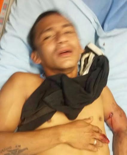 Uno de los jóvenes lesionados tras la balacera, se salvó de milagro/ Plumas Libres